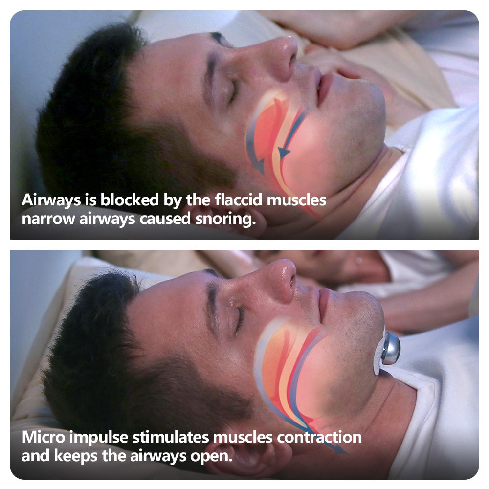 Smart Anti-Snoring Device – Electronic Muscle Stimulator Pro